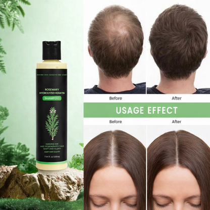 KeraThyme™ Rosemary Hydrolyzed Keratin Shampoo - Stronger Hair, Less Breakage, Pure Botanical Repair