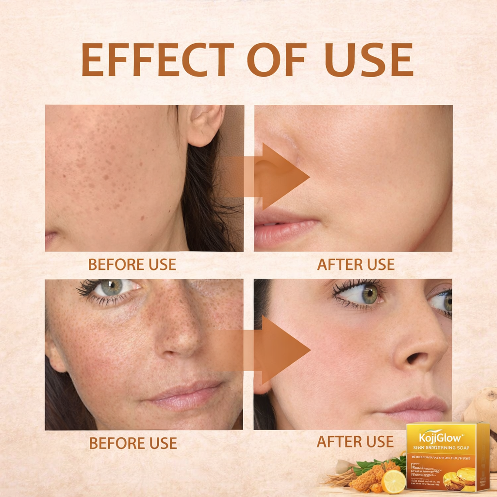 KojiGlow™ Skin Brightening Soap - Brighter Skin, Fewer Dark Spots, Just Pure Glow