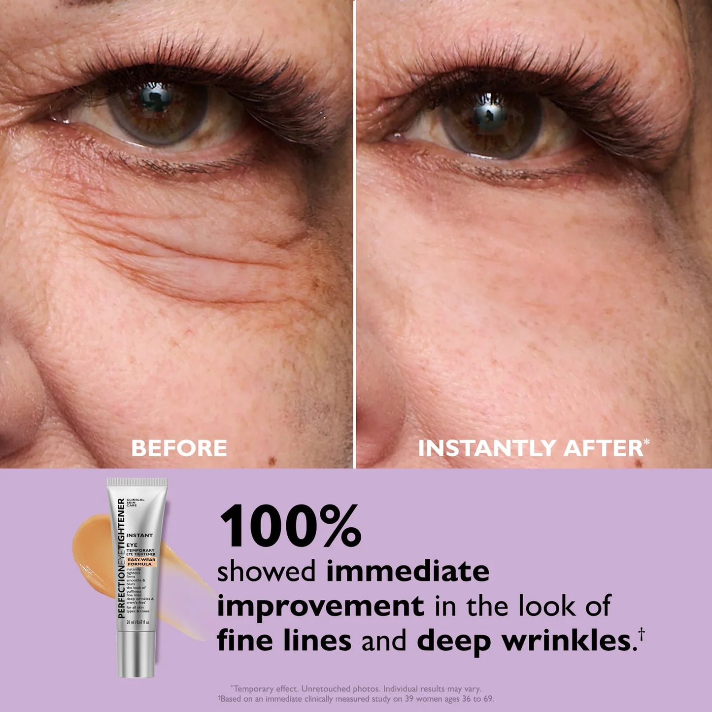 InstantEye™ - Eye Tightening Solution