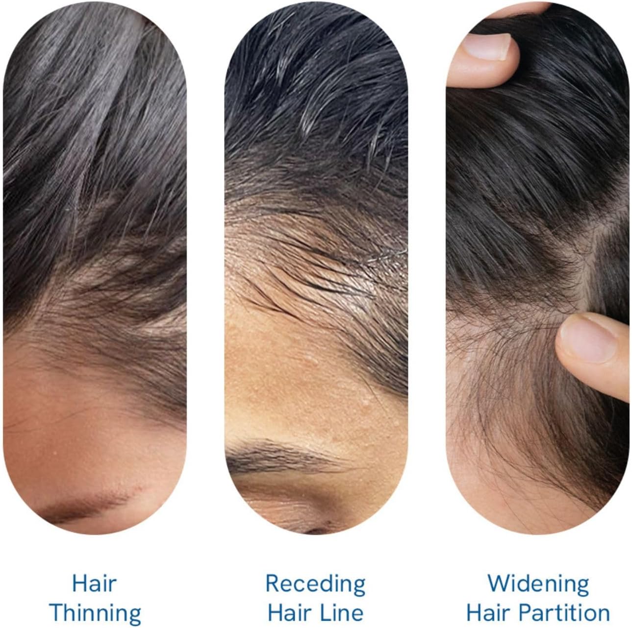 Be-Bodywise™ Rosemary Hair Growth Serum - Thicker Roots, Less Hair Fall, Pure Growth Power